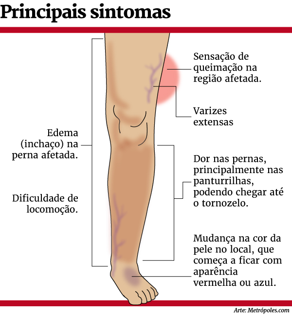 Kácio Pacheco/Metrópoles