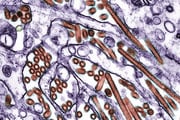 Imagem mostra foto de microscópio do vírus H5N1, da gripe aviária 