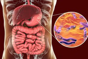 A boa alimentação pode ajudar a combater a H. pylori 
