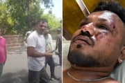 Homem que sobreviveu ao acidente aéreo na Índia 