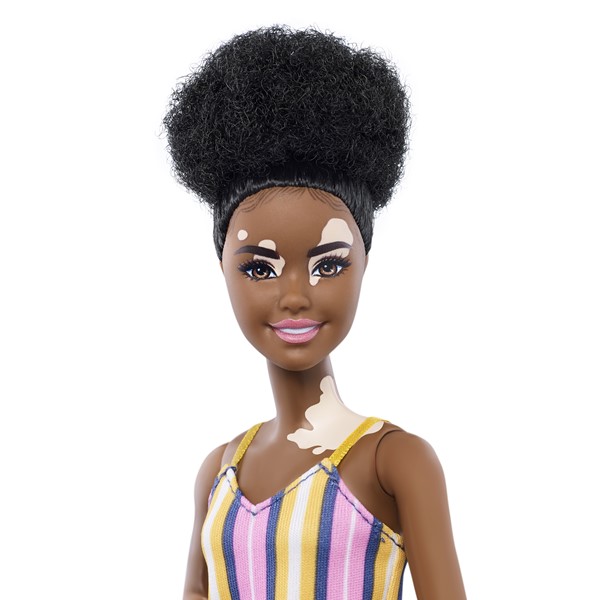 na foto, boneca barbie negra e com vitiligo