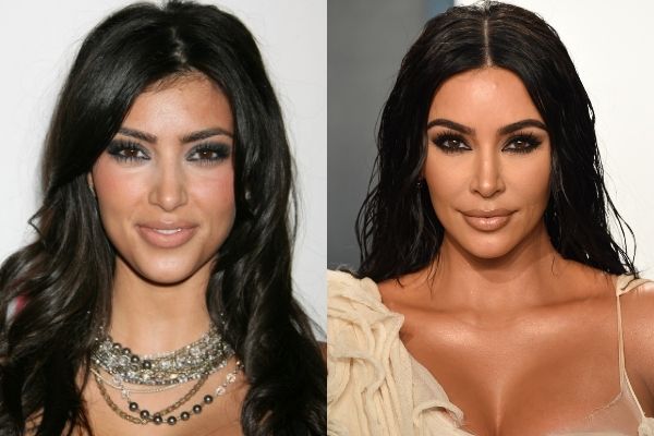 kim Kardashian antes e depois