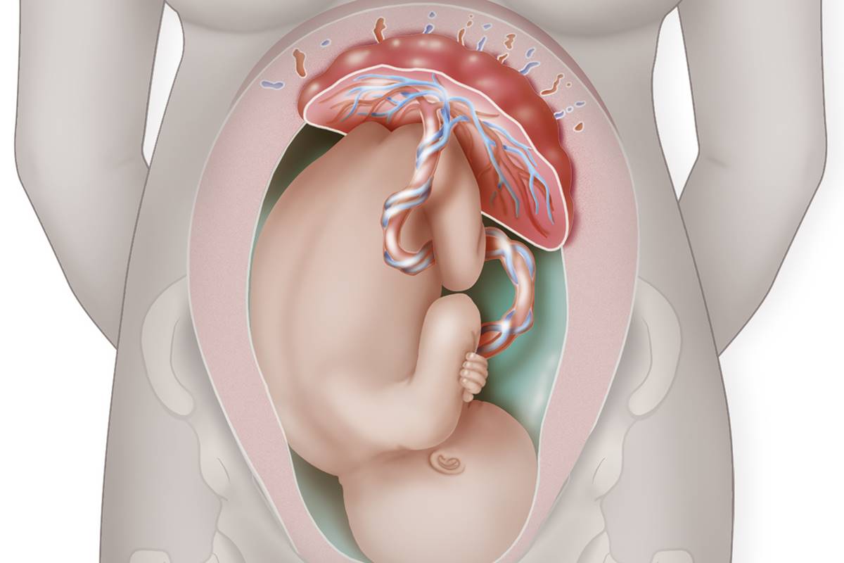 Cientistas encontram microplásticos em placenta humana pela primeira vez | Metrópoles