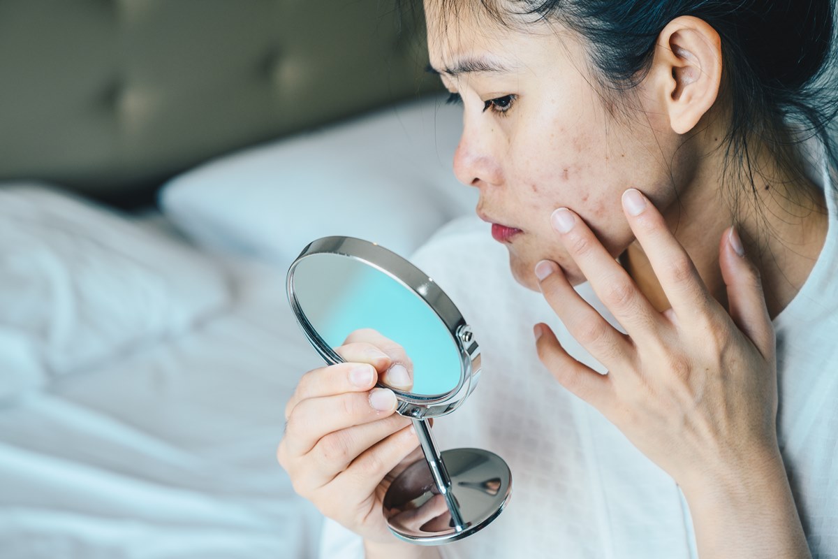 Foto de mulher olhando acne no rosto em espelho - Metrópoles