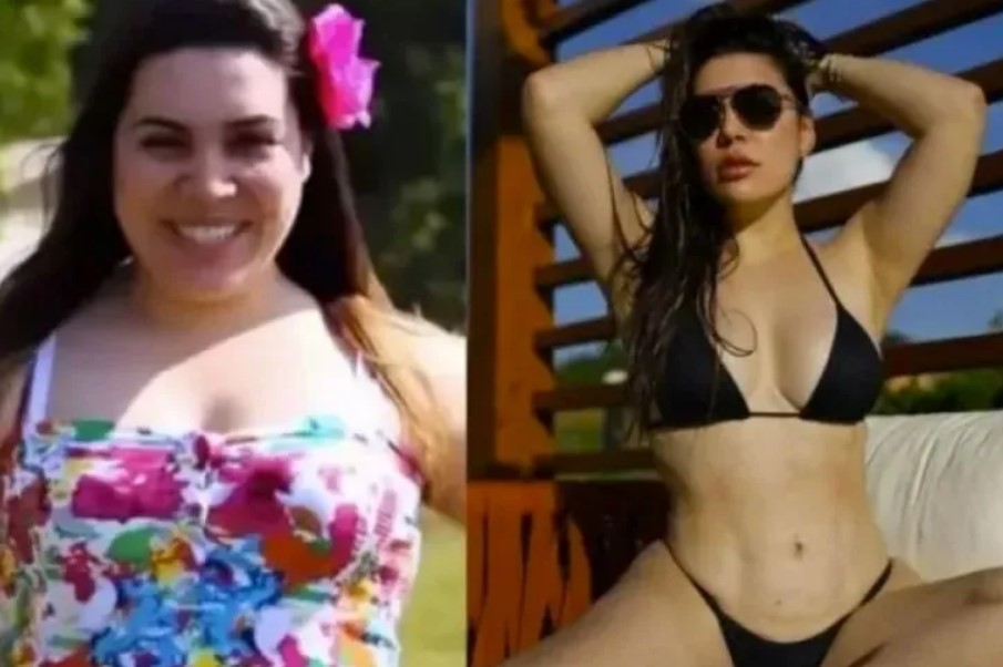 Naiara Azevedo antes e depois dos procedimentos estéticos