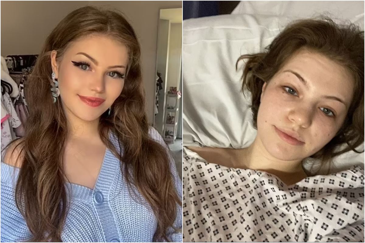 Modelo do OnlyFans passa por apuros após cirurgia vaginal Metrópoles(01)
