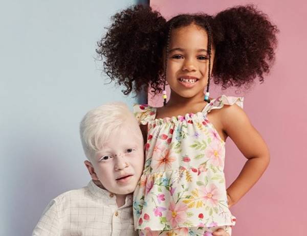 Campanha de Dia das Crianças 2022. Na imagem, menino albino é abraçado por menina negra