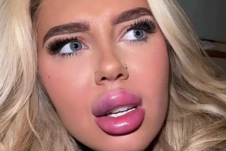 [Image: Tiktok_labios_de_cachorro_quente.jpg]
