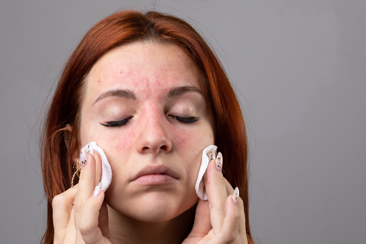 Foto de uma mulher branca e de olhos fechados passando dois algodões no rosto para limpá-lo