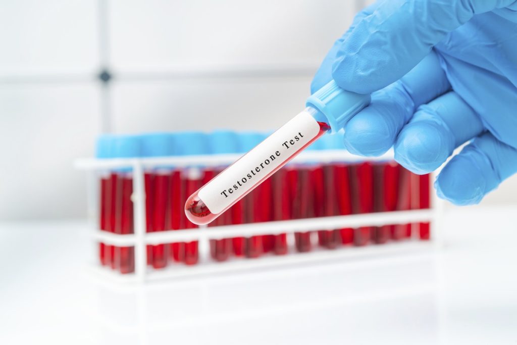 Imagem de um mão com luva cirúrgica segurando um tubo de ensaio com sangue e uma etiqueta dizendo "teste de testosterona" - Metrópoles
