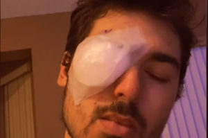 Michael Krumholz cego por dormir de lente de contato - Metrópoles