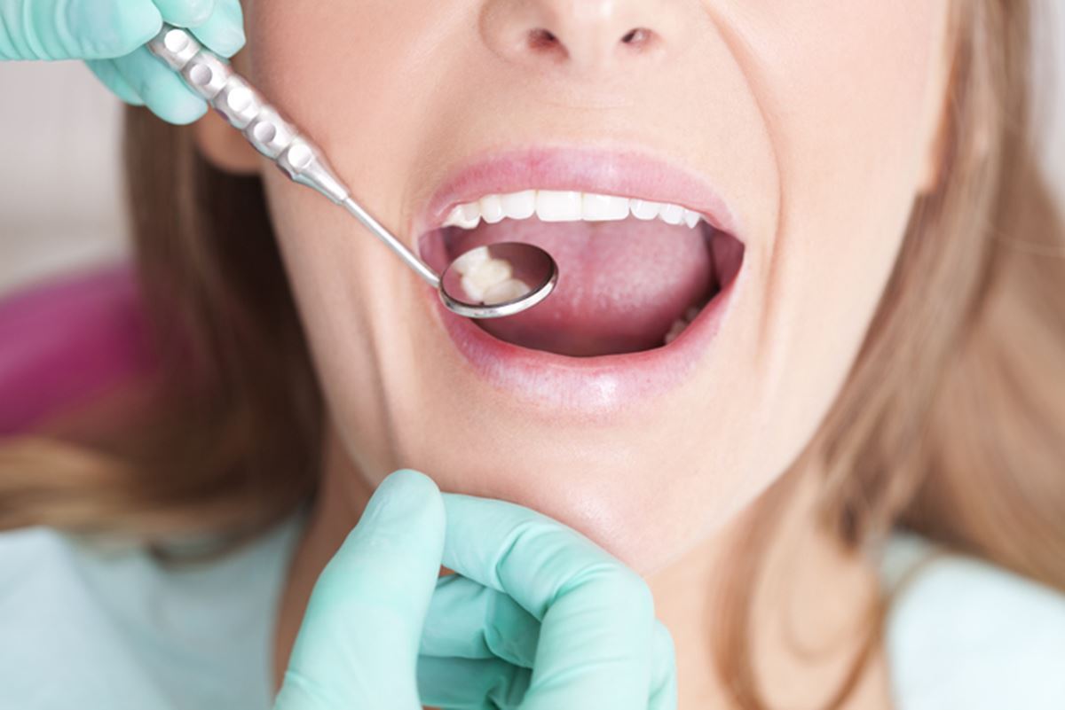 Foto de mulher com boca aberta sendo examinada por dentista - Metrópoles