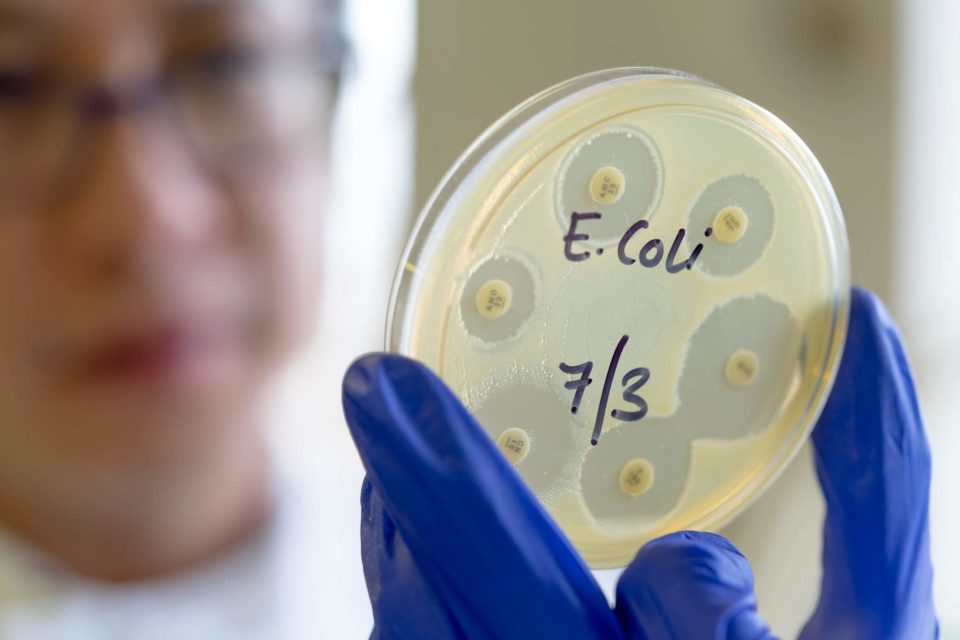 Foto mostra cientista com colônia de bactérias e. coli nas mãos