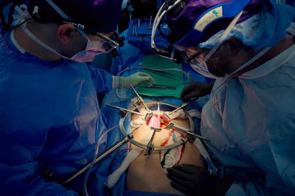 Foto colorida de médicos em sala de cirurgia fazendo transplante - Metrópoles