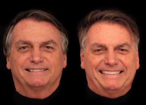 Bolsonaro harmonização