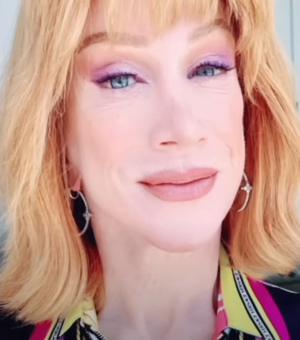 resultado de procedimento estético em Kathy Griffin