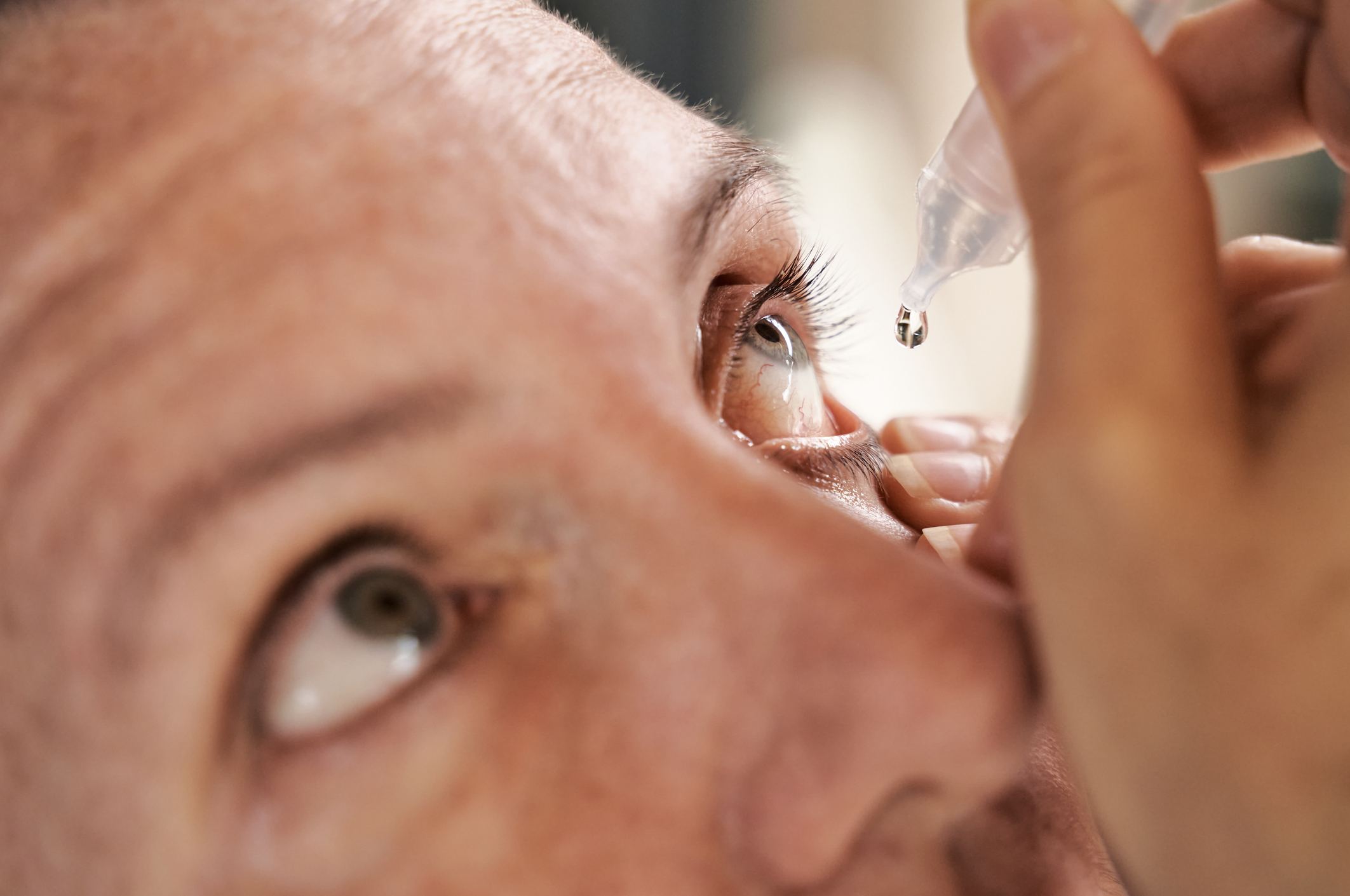 Foto mostra mulher aplicando colírio nos olhos - Metrópoles