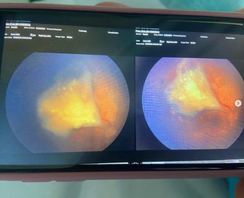 imagem colorida de exame que mostra interior dos olhos - Metrópoles