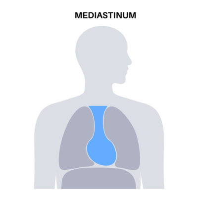 Imagem colorida de desenho com mediastino em destaque azul - Metrópoles