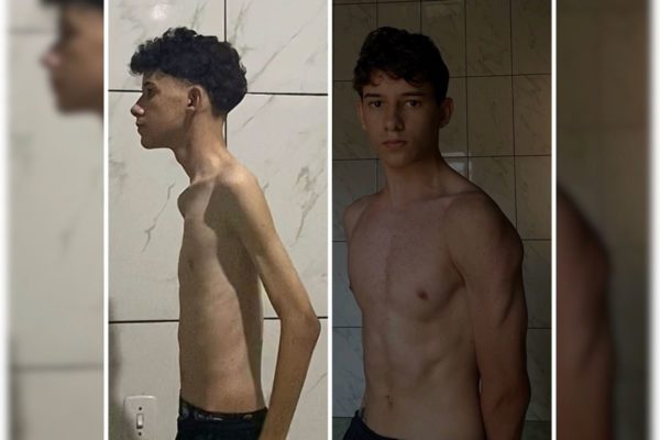 Imagem colorida de jovem magro na esquerda de lado e jovem forte na direita de lado - Metrópoles