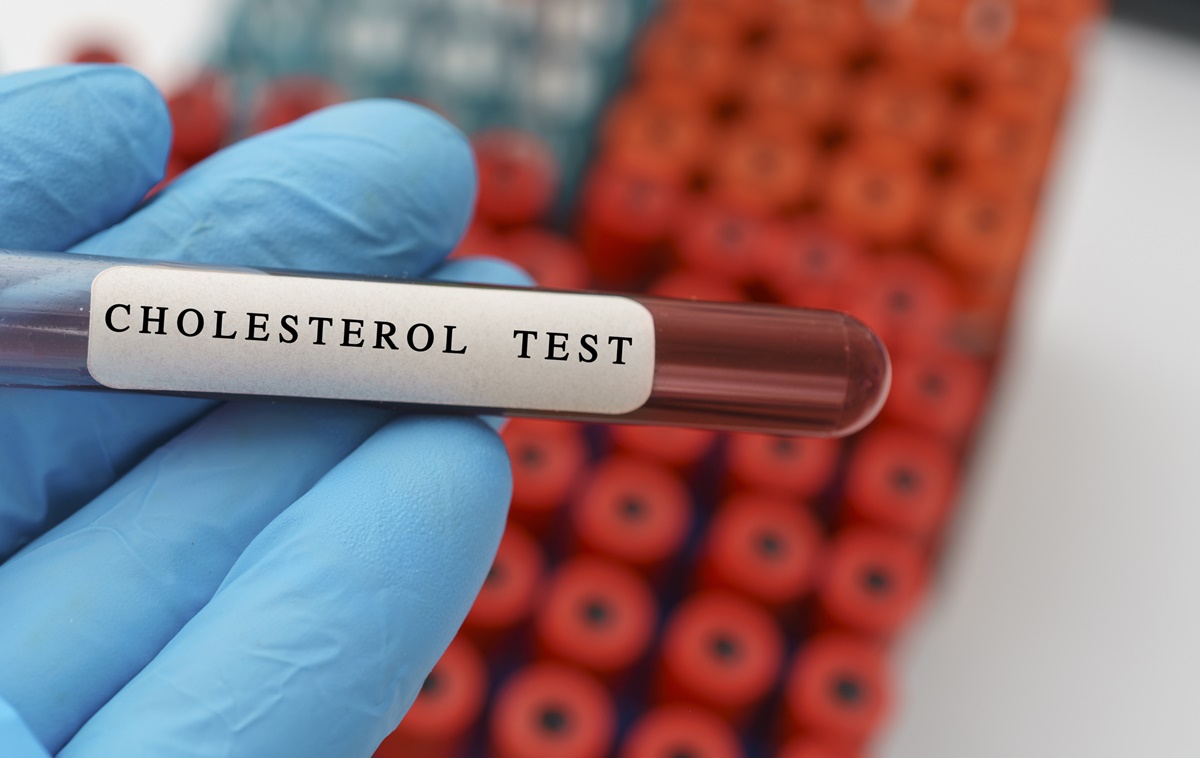 Dedos segurando tubo de ensaio com exame de sangue de colesterol - Metrópoles