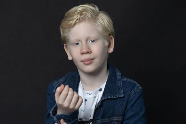 Foto de um menino albino, com cabelo loiro, usando uma camisa branca e uma jaqueta jeans - Metrópoles