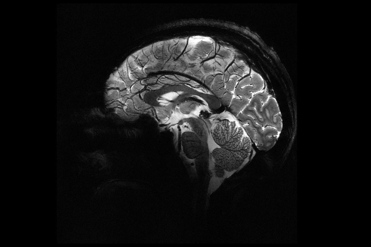 Imagem mostra o cérebro a partir de ressonância magnética de resolução inédita - Metrópoles