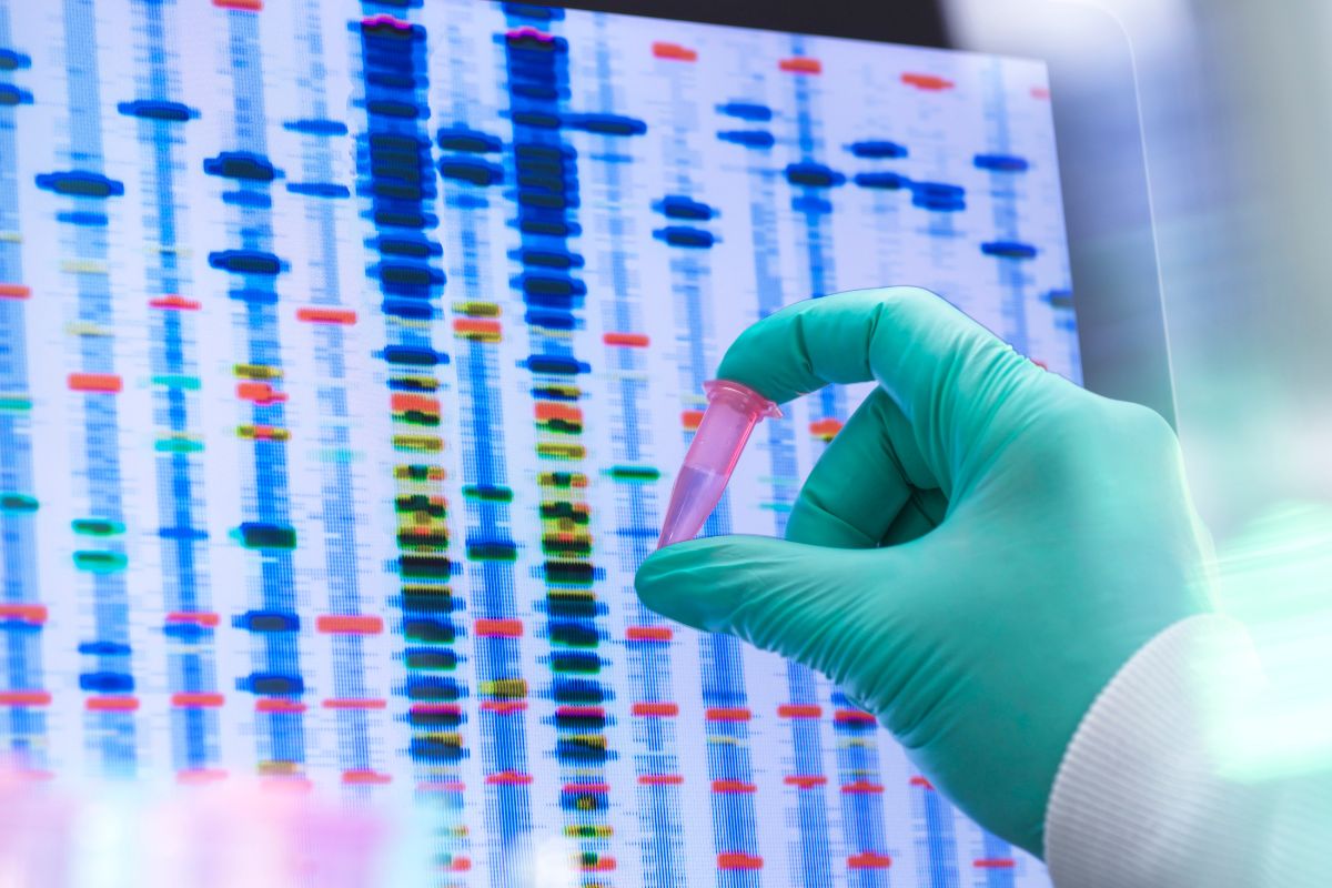 Foto colorida de um exame de DNA - Metrópoles