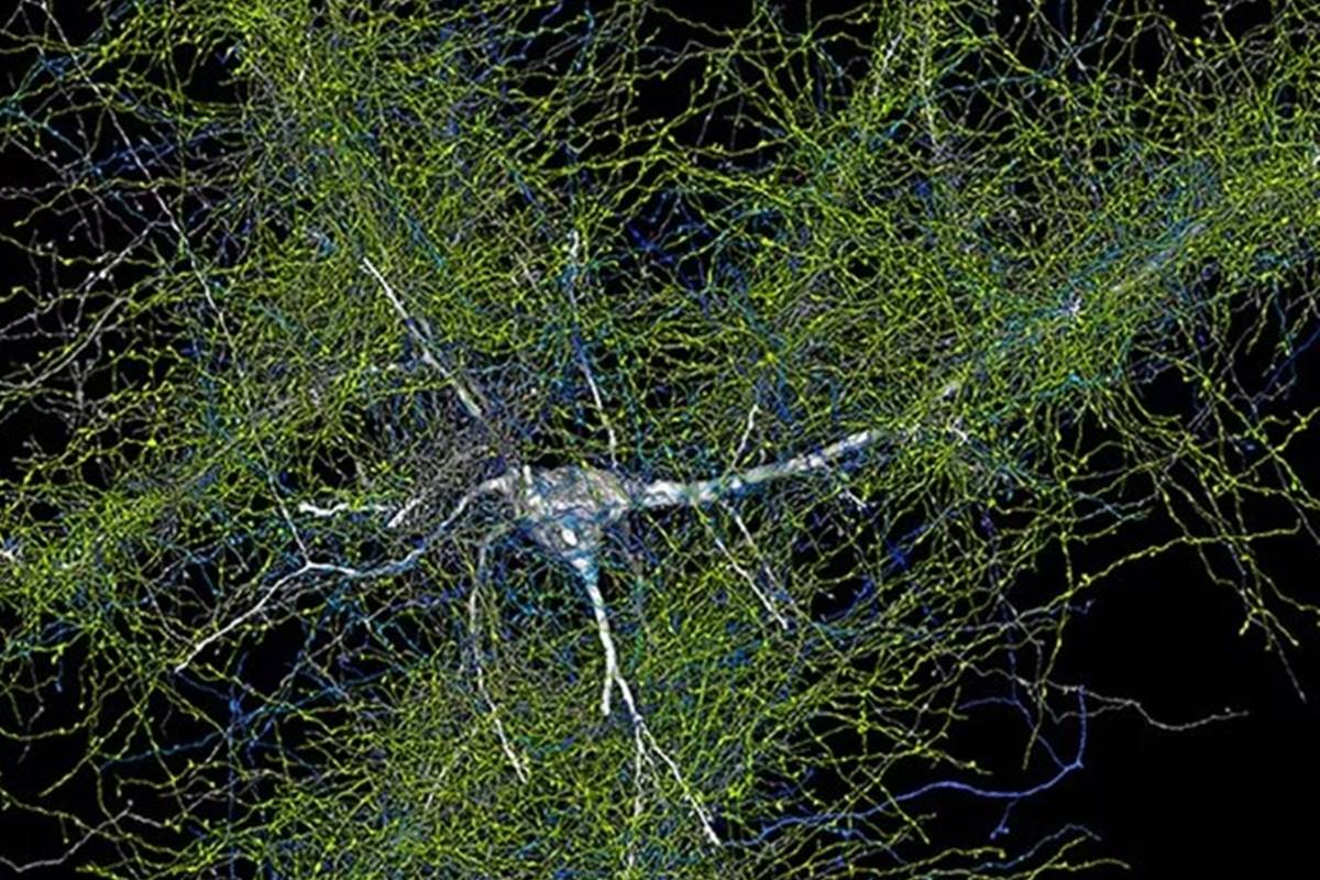 Ilustração de um neurônio no cérebro - Metrópoles