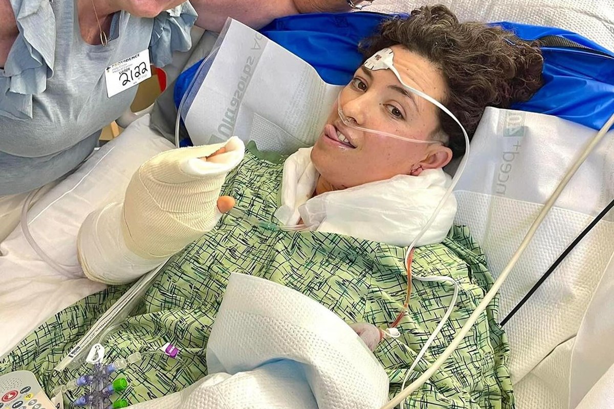 Imagem colorida mostra mulher com tubos e machucados, internada em hospital enquanto posa para foto - Metrópoles