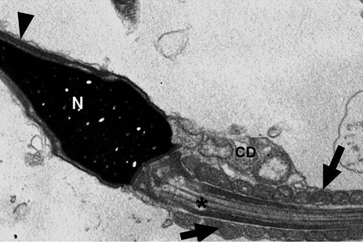 Imagem de espermatozoide de paciente com Covid