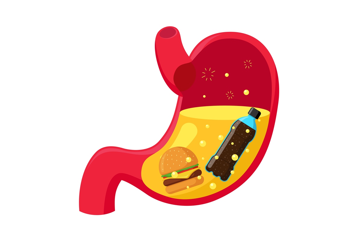 Desenho colorido de estômago com garrafa de refrigerante e hambúrguer dentro - Metrópoles