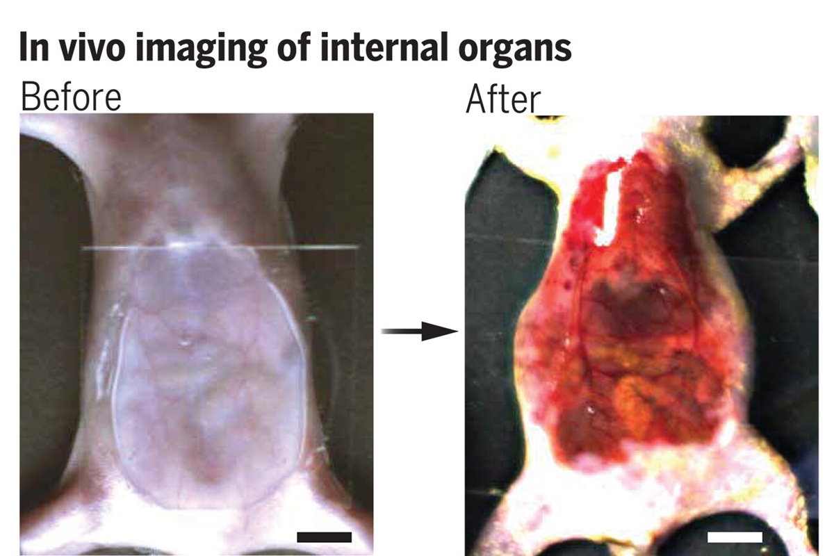 Imagem com duas fotos de corpo de camundongo em experimento - Metrópoles