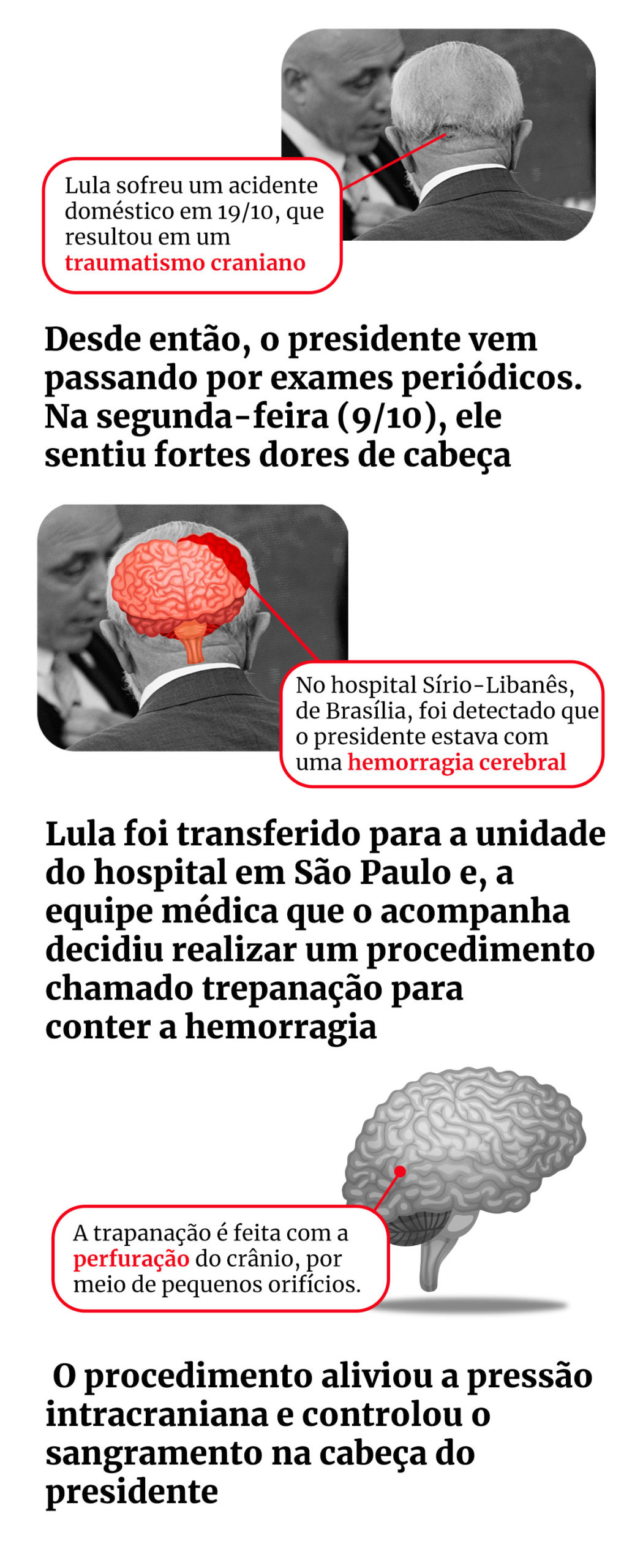 Infográfico sobre hemorragia intracraniana do presidente Lula - Metrópoles