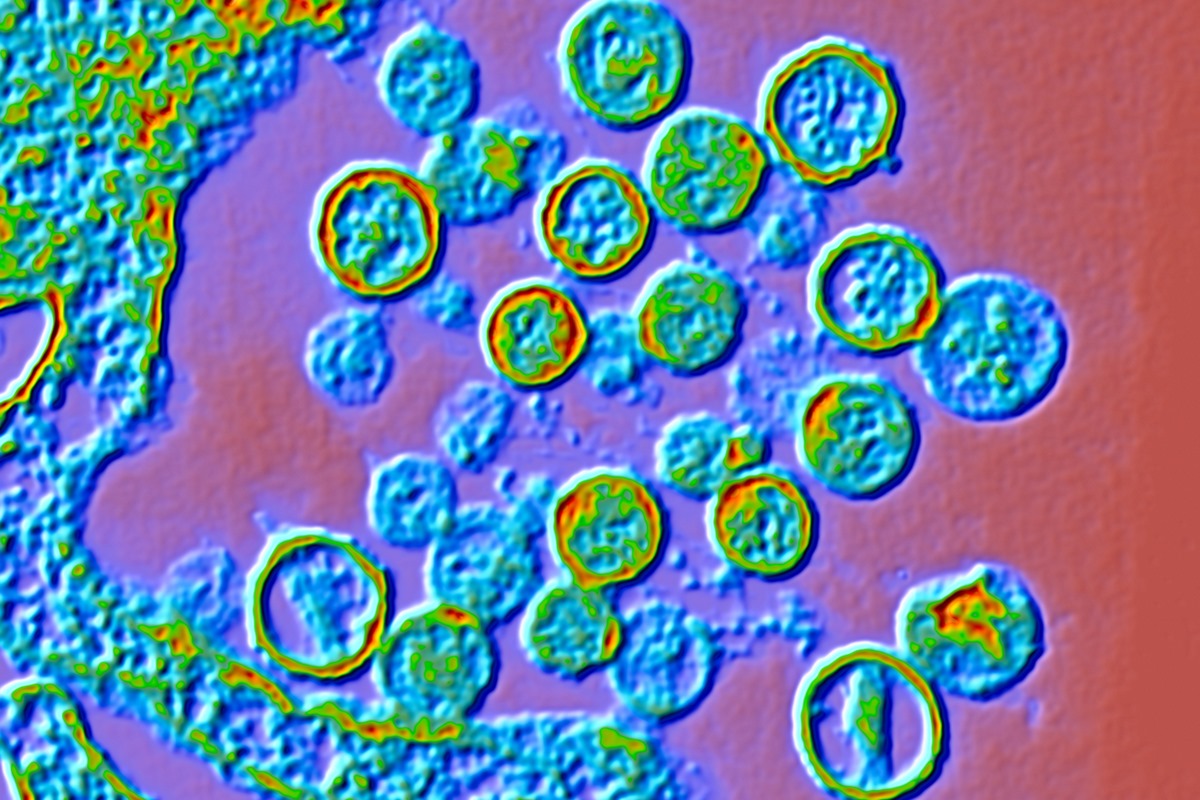 Micrografia eletrônica de transmissão (TEM) colorida de partículas de Hantavírus. Metrópoles