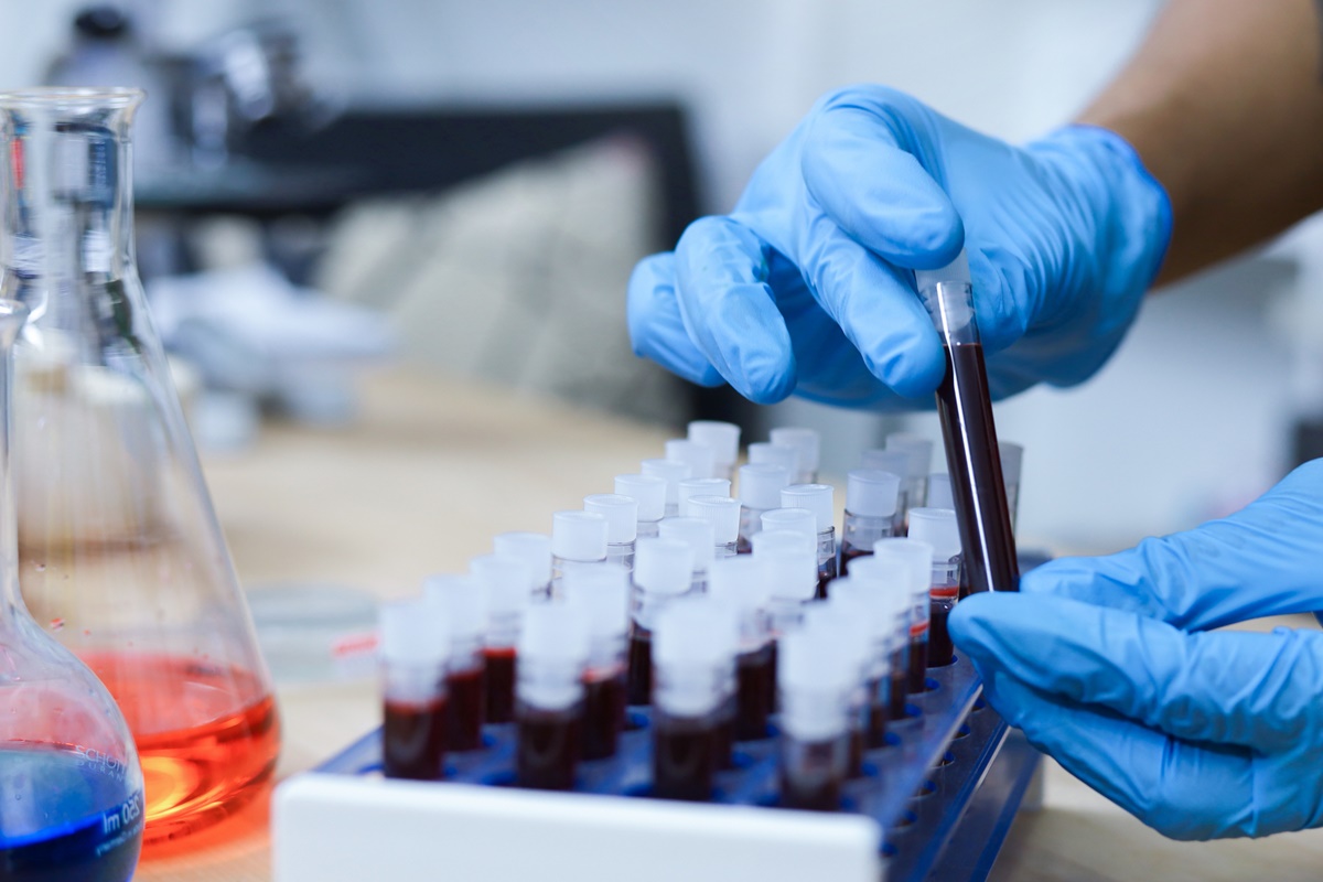 Por que é importante manter exames de sangue em dia mesmo sem sintomas