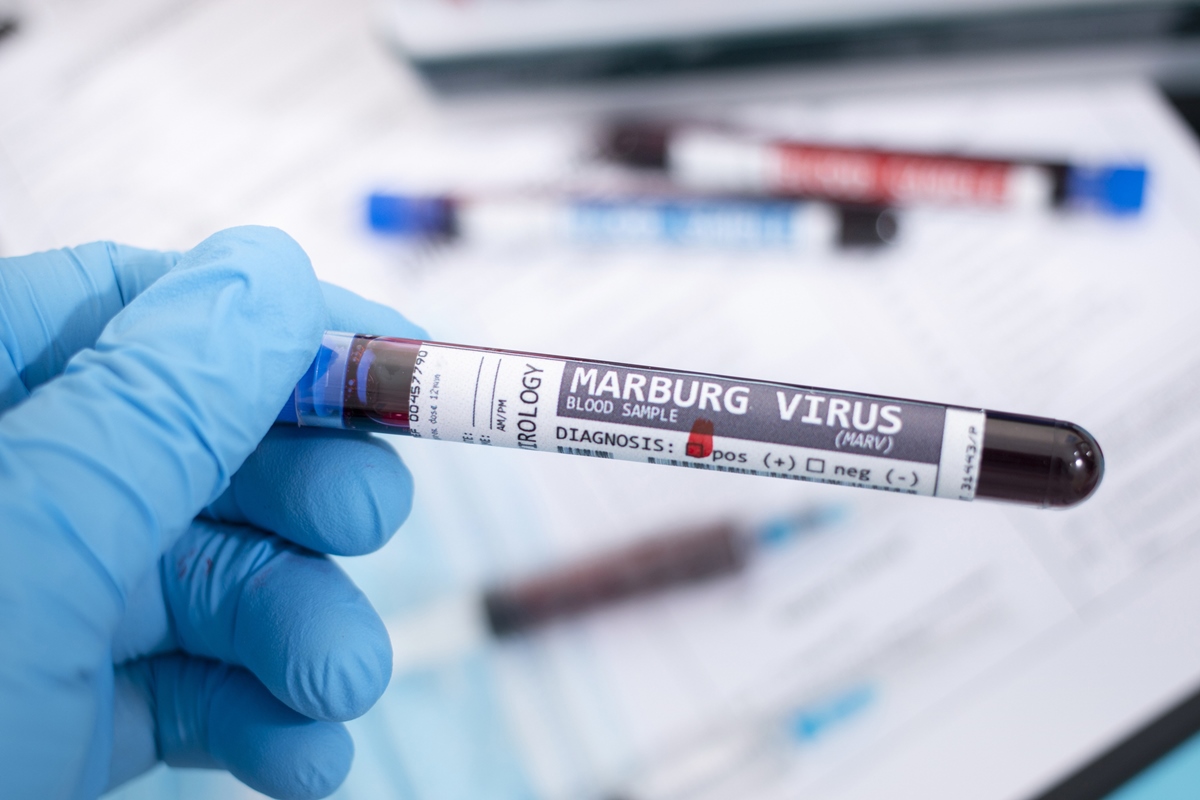 Amostras de sangue fictícias com vírus marburg infectado, com estetoscópio, máscara e seringa e outras coisas. Metrópoles