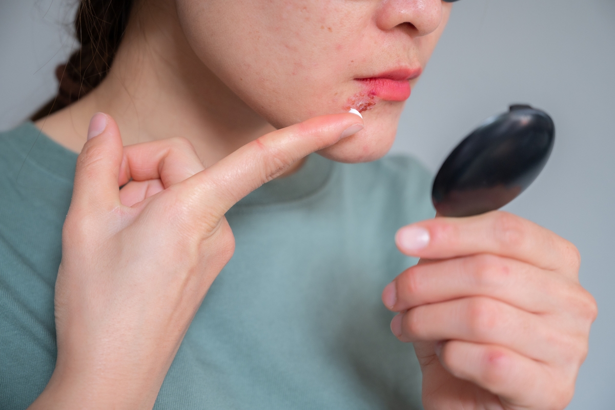 Especialista explica a correlação entre herpes e Alzheimer