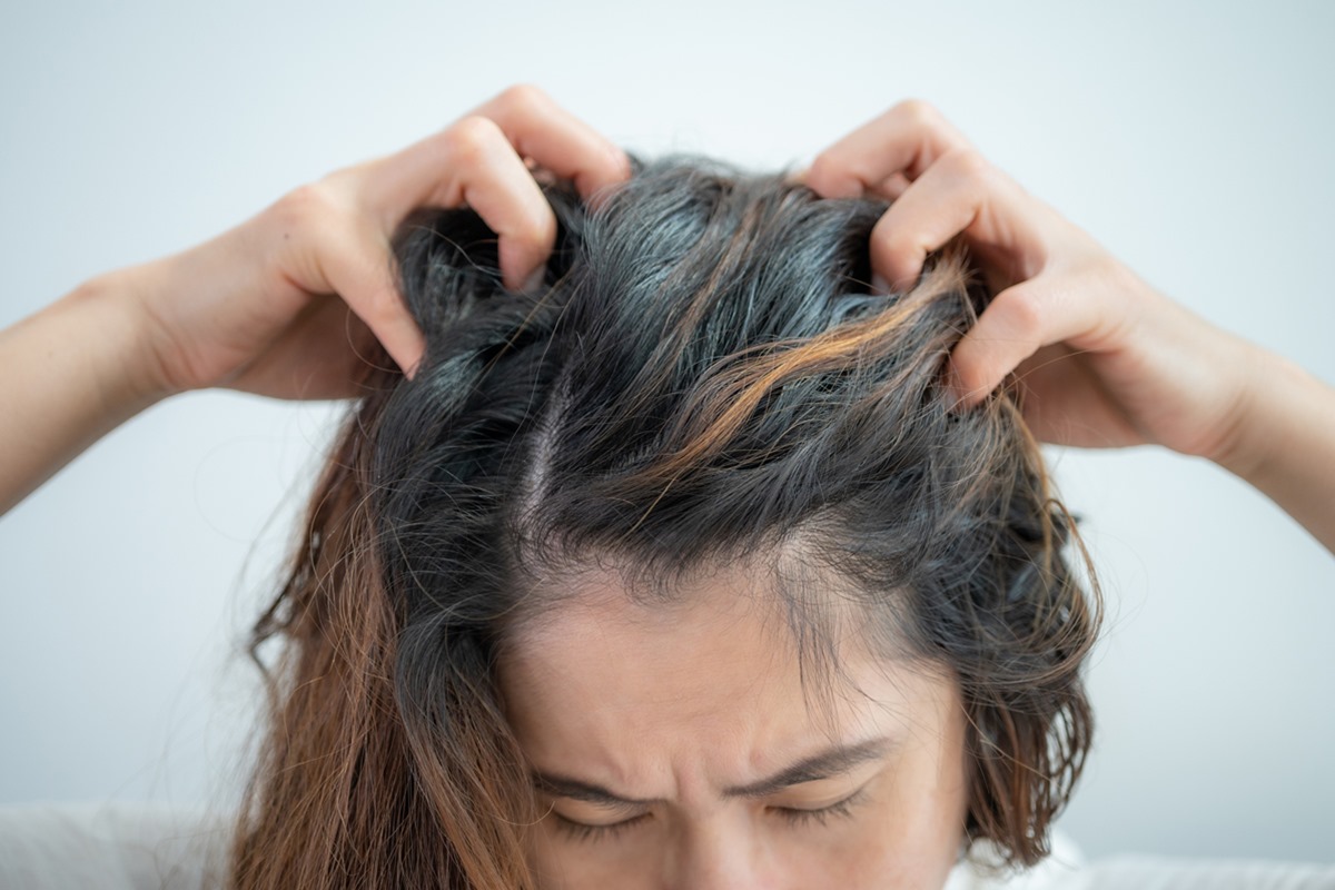 Coceira no couro cabeludo é um sintoma comum e desconfortável que pode ser causado por problemas de pele e parasitas.