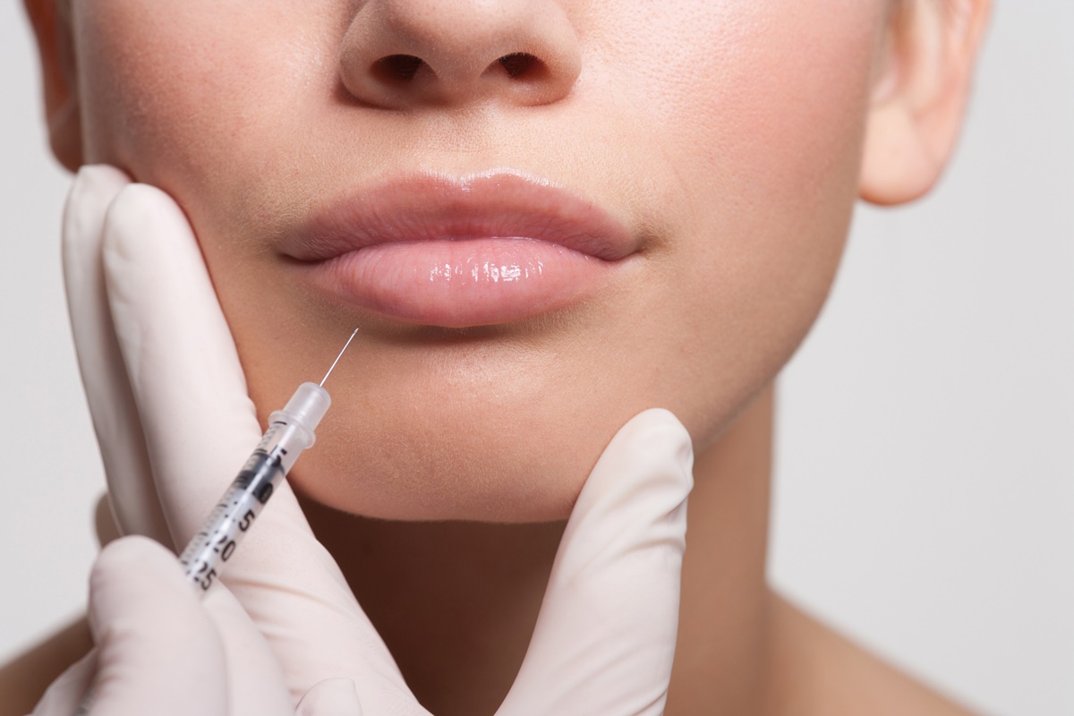 Close up de mulher recebendo injeção de botox nos lábios. Metrópoles