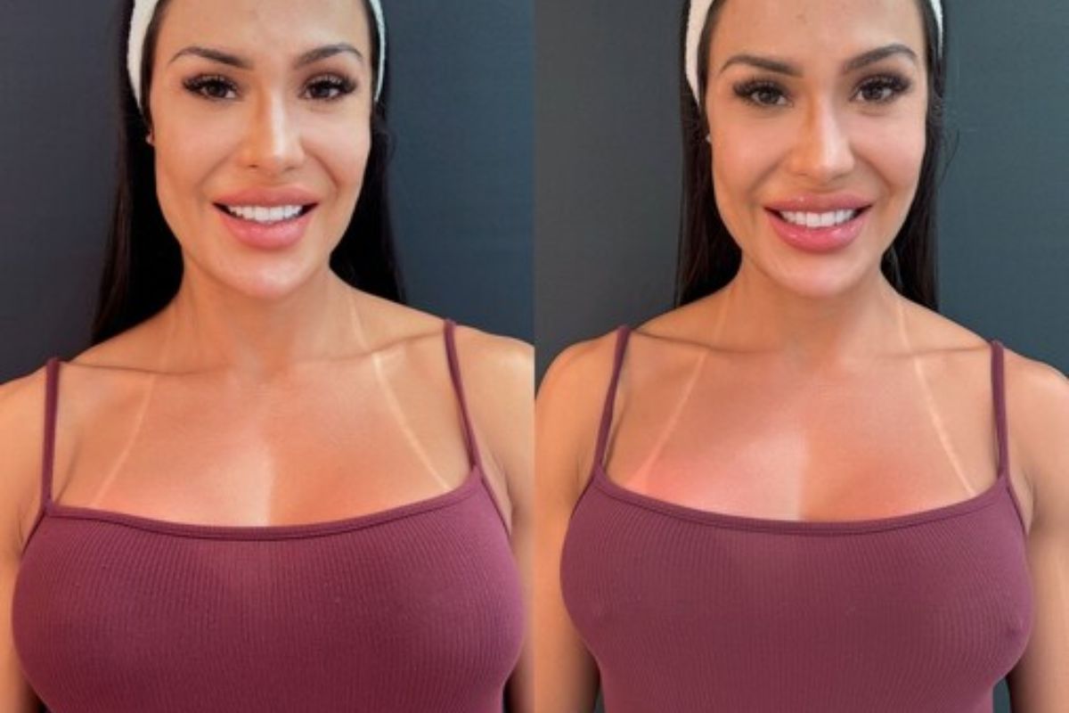 Gracyanne Barbosa faz procedimento íntimo curioso: “Mais sensual”