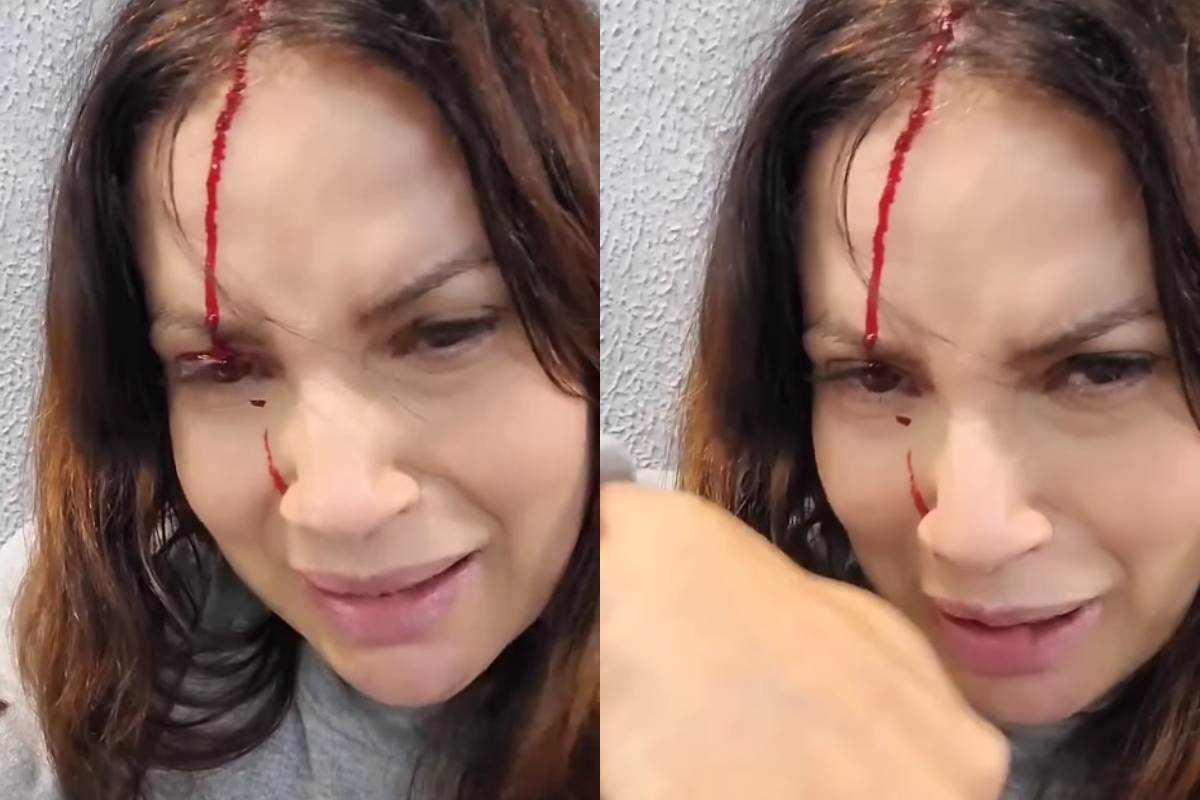 Isadora Ribeiro sofre acidente e aparece sangrando em vídeo