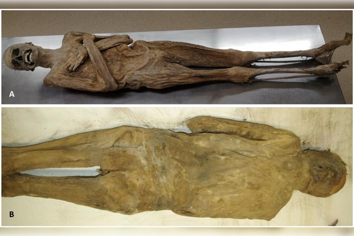 Aspecto externo da múmia do lado ventral (A) e dorsal (B) mostrando uma parede corporal completamente intacta. Metrópoles