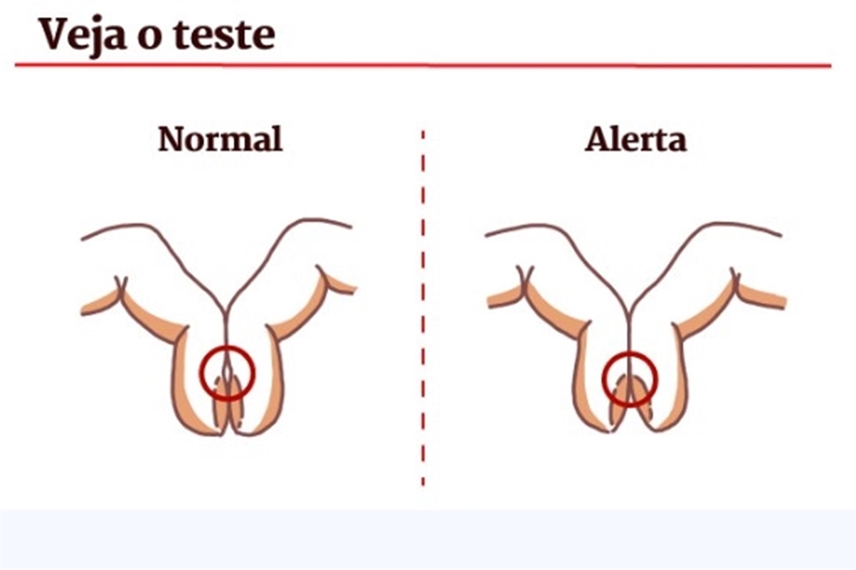Ilustração mostra como fazer teste que mostra problemas respiratórios nas unhas - Metrópoles