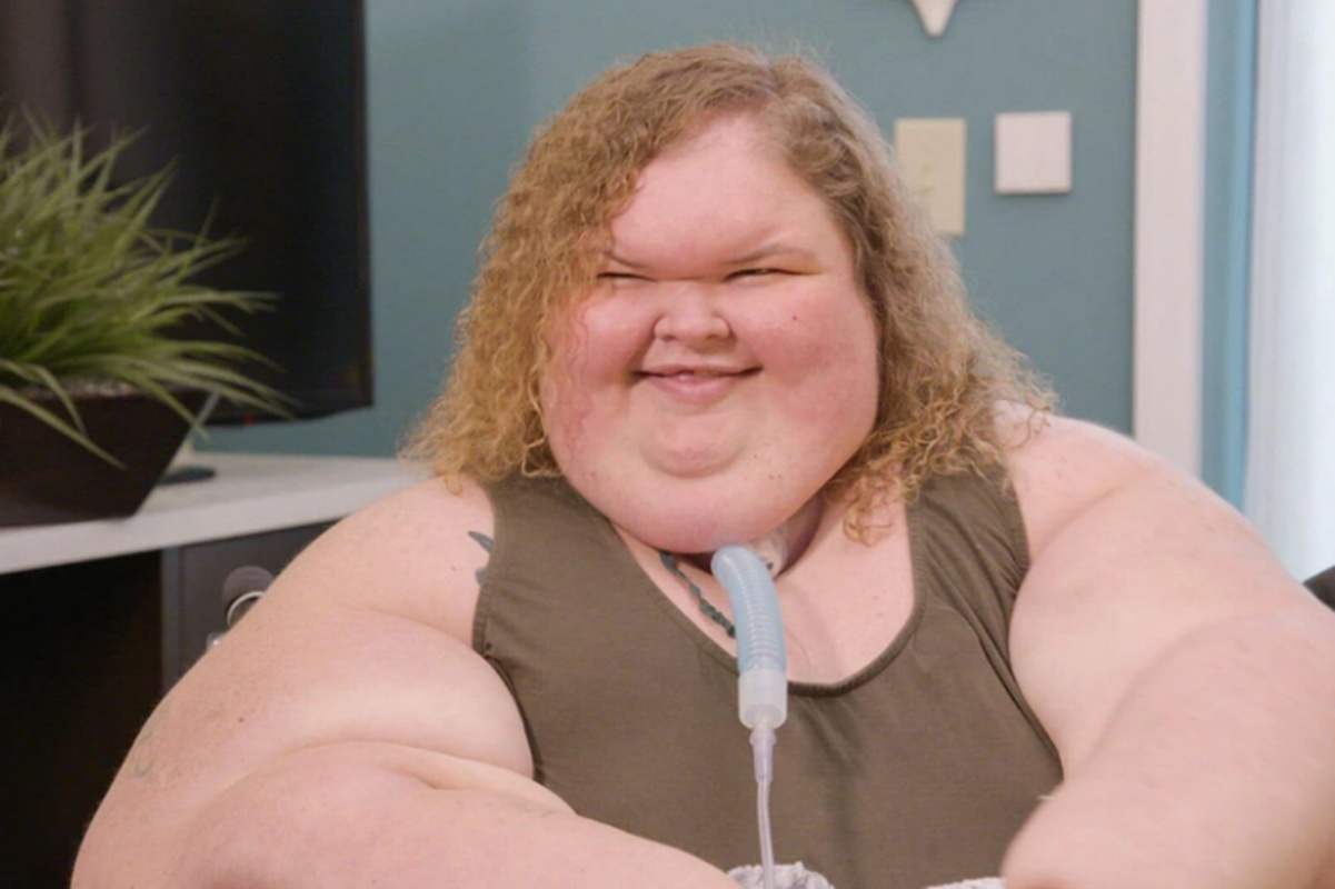 Transformação Incrível! Ex-Estrela de Reality Show Chocaa com Perda de Peso de 226kg e Novos Procedimentos Estéticos