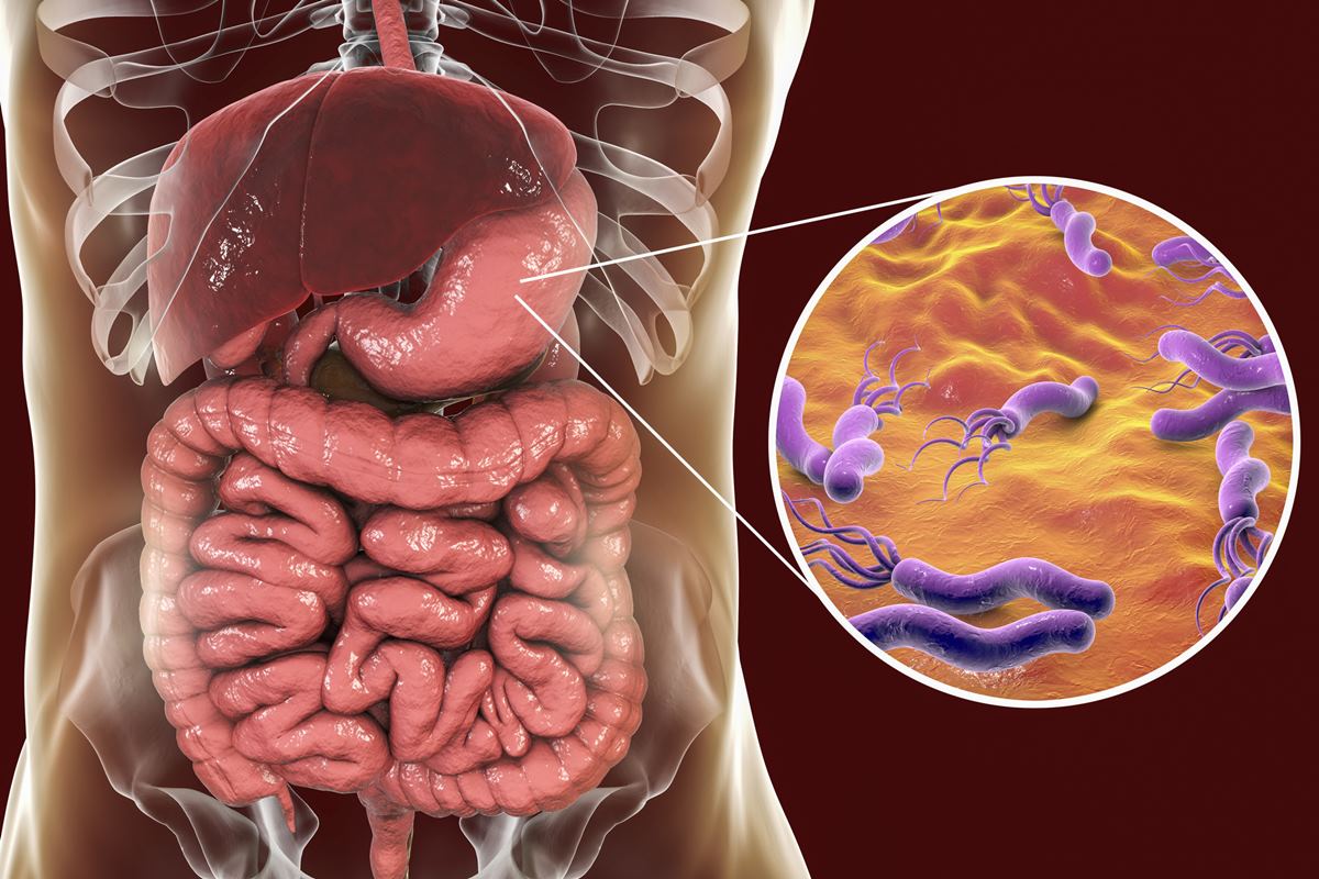 Foto colorida de sistema digestivo e uma lupa com a bactéria H. pylori - Metrópoles