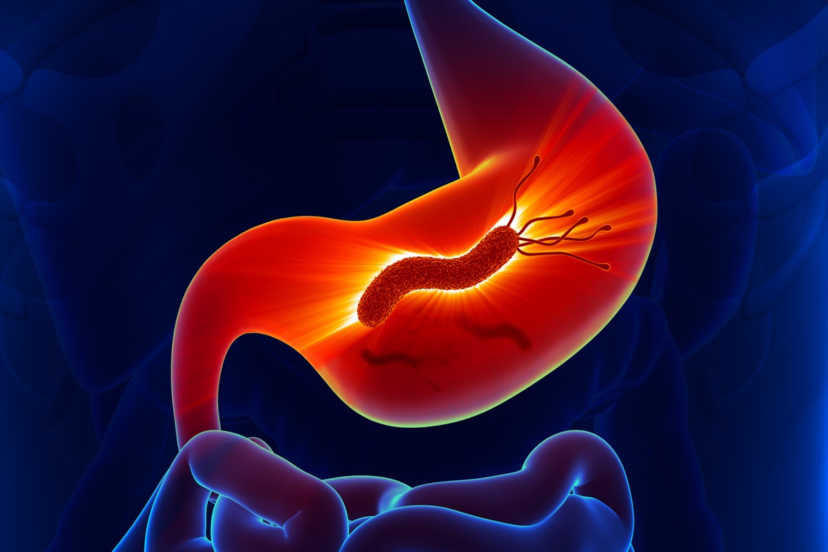 Foto colorida de bactéria H. pylori dentro do estômago - Metrópoles
