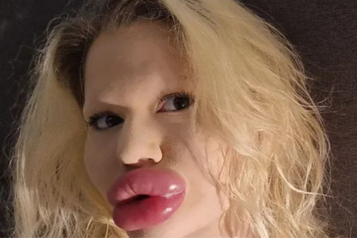 foto colorida de mulher com os maiores lábios do mundo