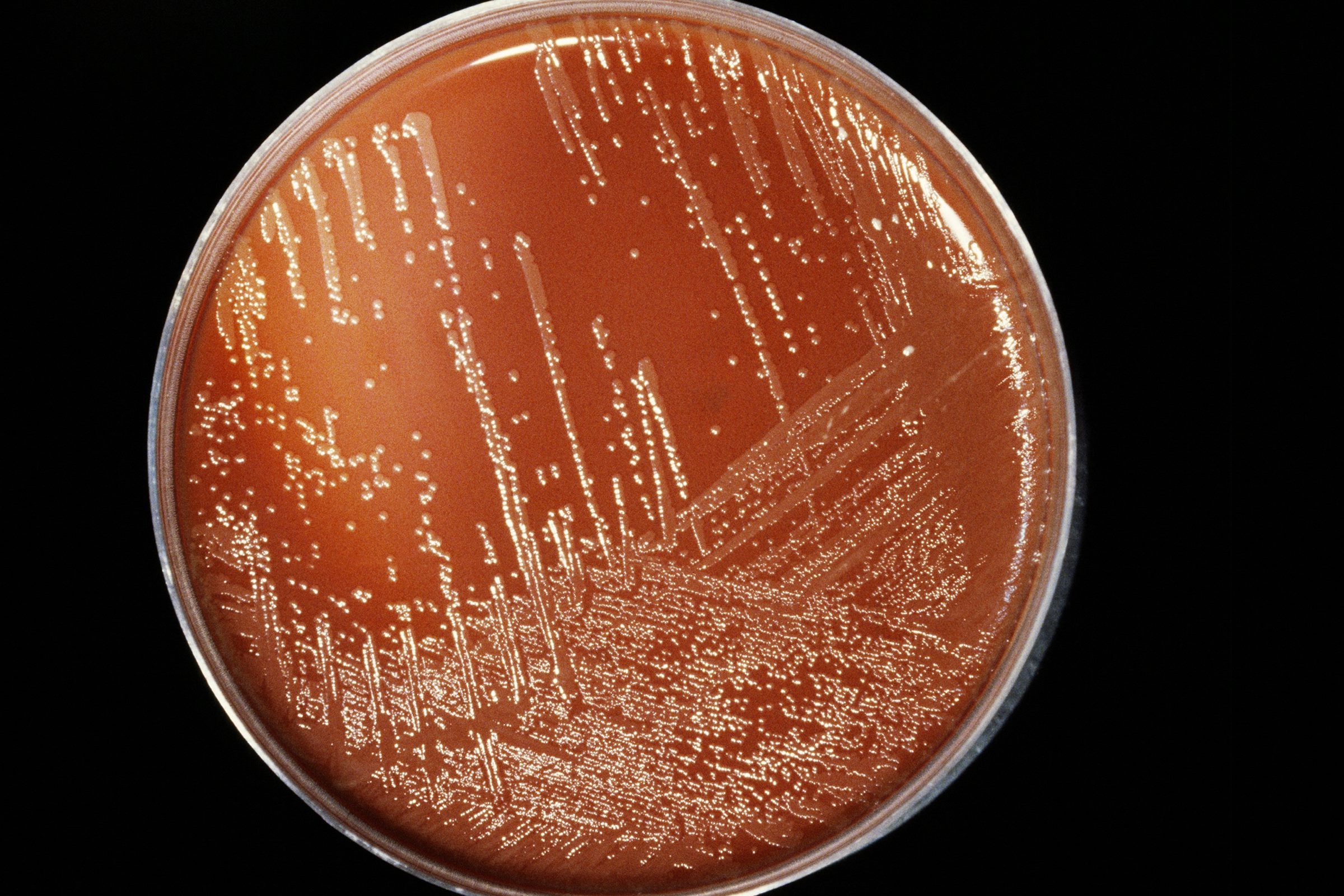 Imagem mostra placa de Petri contaminada com a bactéria da meningite - Metrópoles