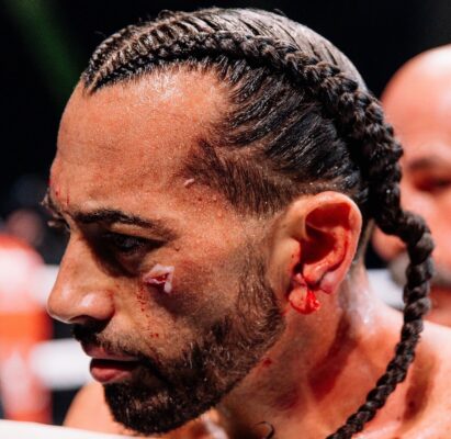 Foto colorida de boxe sem luta - Metrópoles